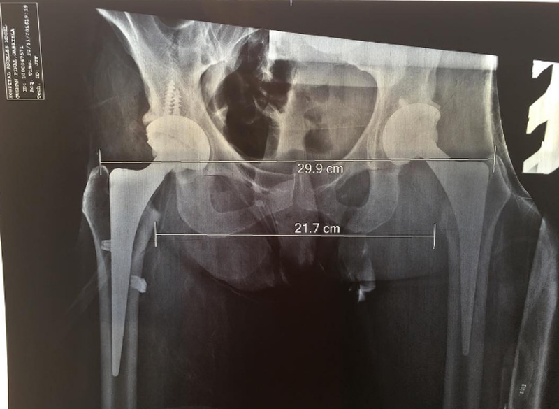 placa-cadera-de-alejandra-guzman