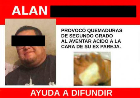 acido2